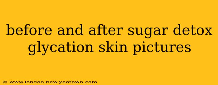 before and after sugar detox glycation skin pictures