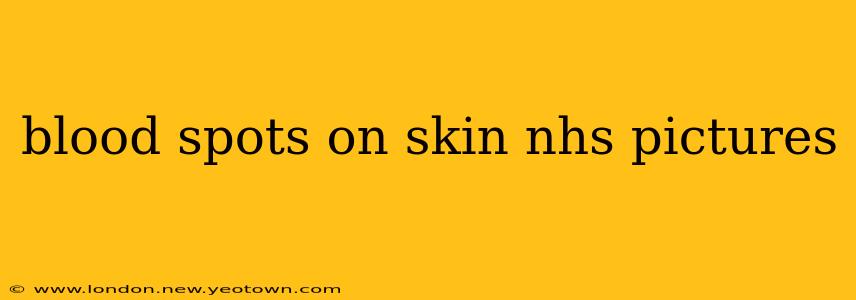 blood spots on skin nhs pictures