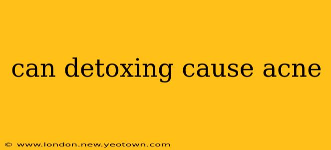can detoxing cause acne