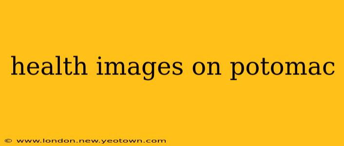 health images on potomac